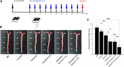 Platelet Membrane Biomimetic Nanoparticles Combined With UTMD to Improve the Stability of Atherosclerotic Plaques